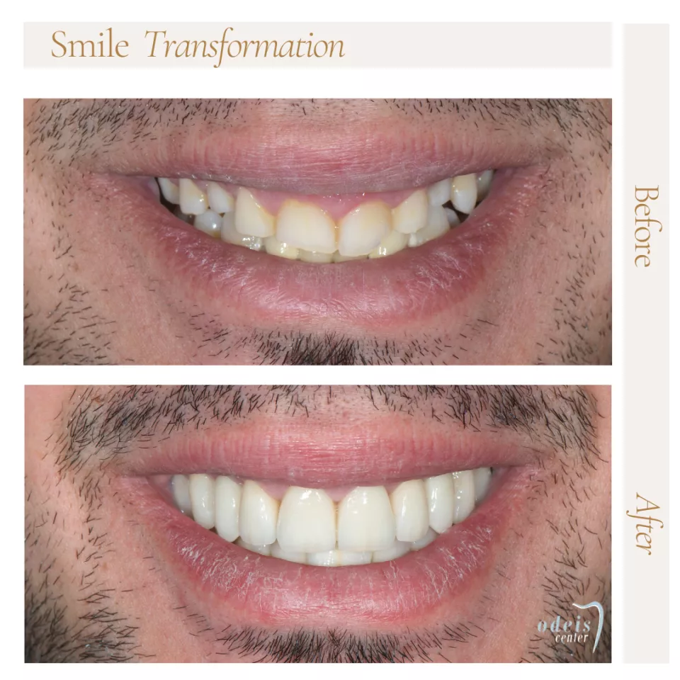 Dentisterie esthétique Uccle