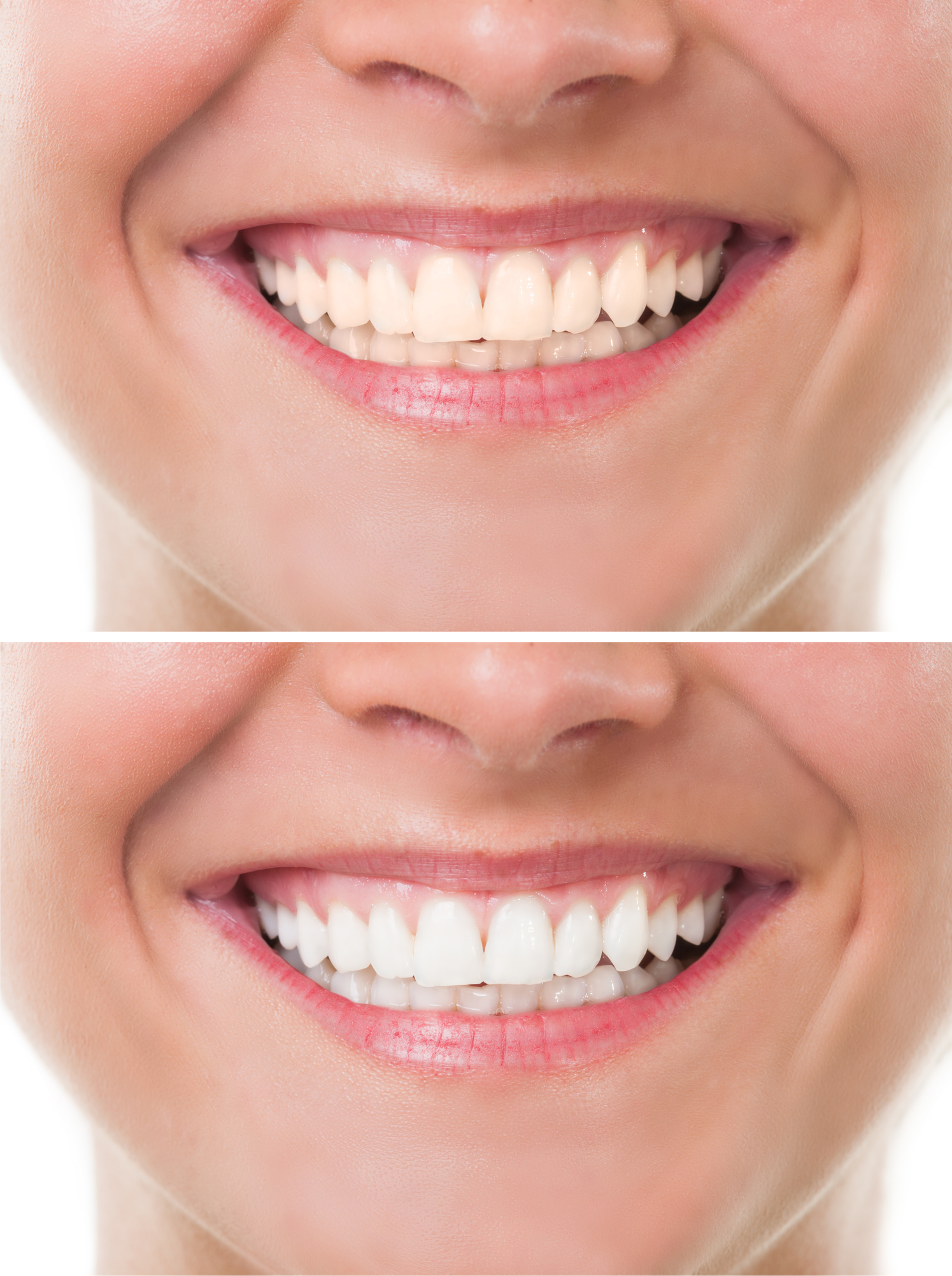 dents blanches et saines