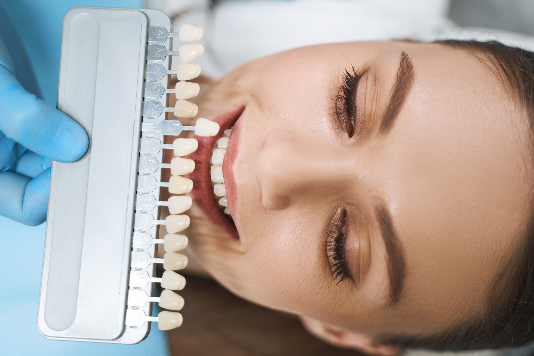 différentes techniques de dentisterie esthétique