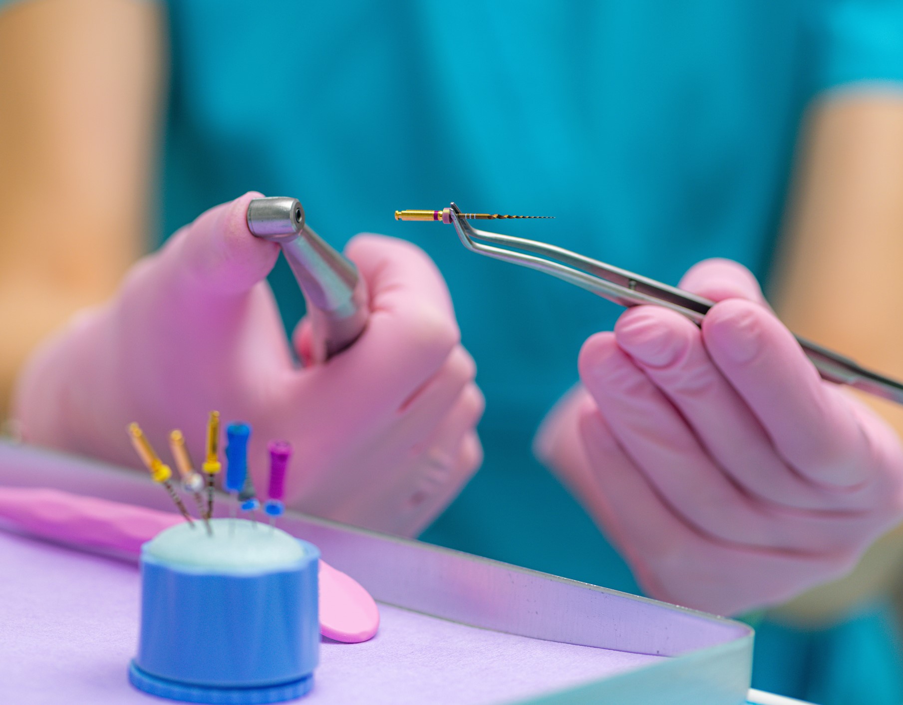 différentes techniques d'endodontie du cabinet dentaire