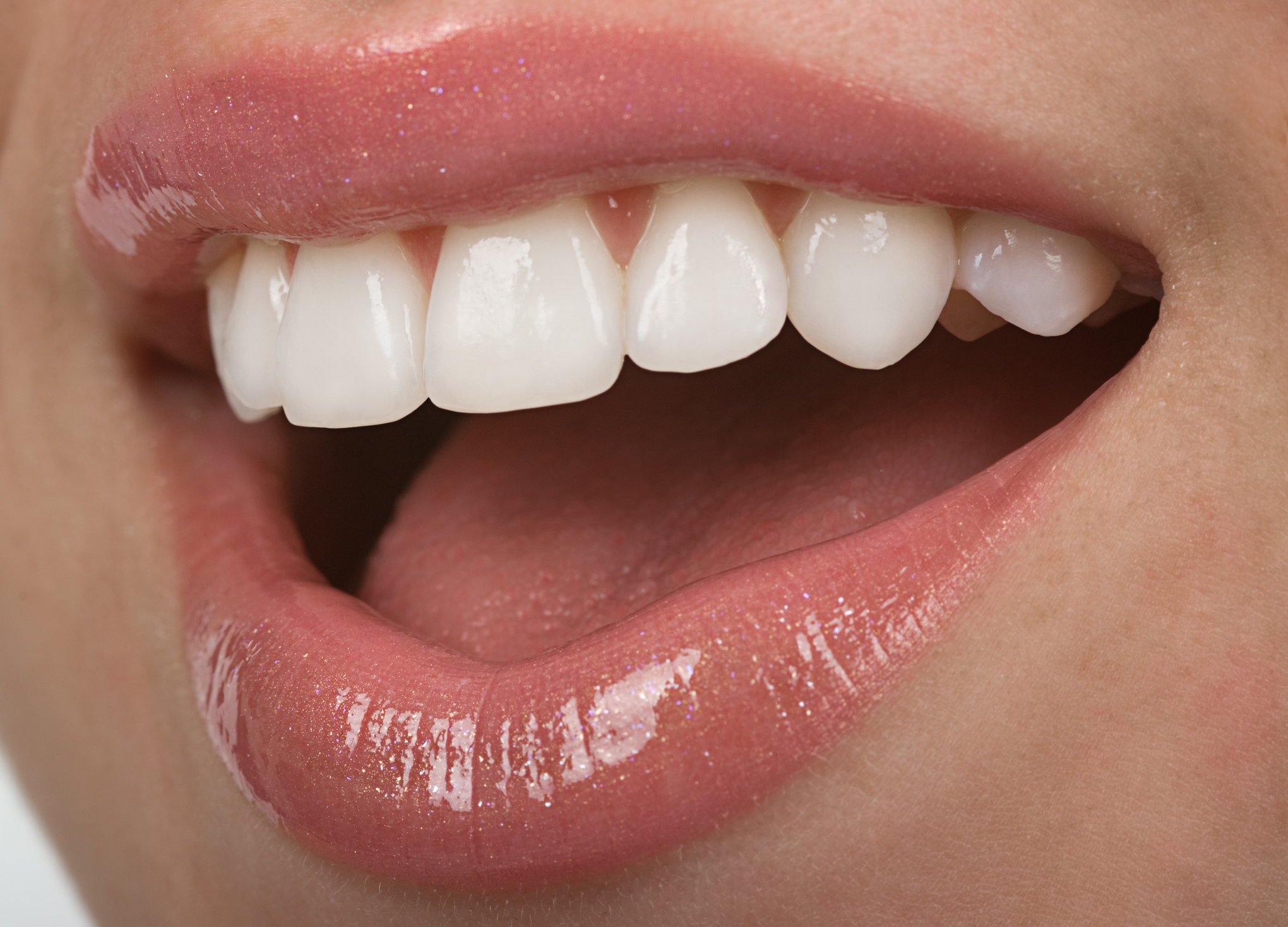 dentisterie esthétique